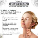 70% Glycolic Acid Serum Peel - with Retinol & Chamomile Green Tea ExtractS (Professional Skin Peel) For Wrinkles, Acne Scars, Fine Lines, Collagen Boost - Anti -Aging Alpha Hydroxy Acid 1oz Bottle